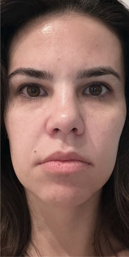 Close-up of a woman's makeup-free face.