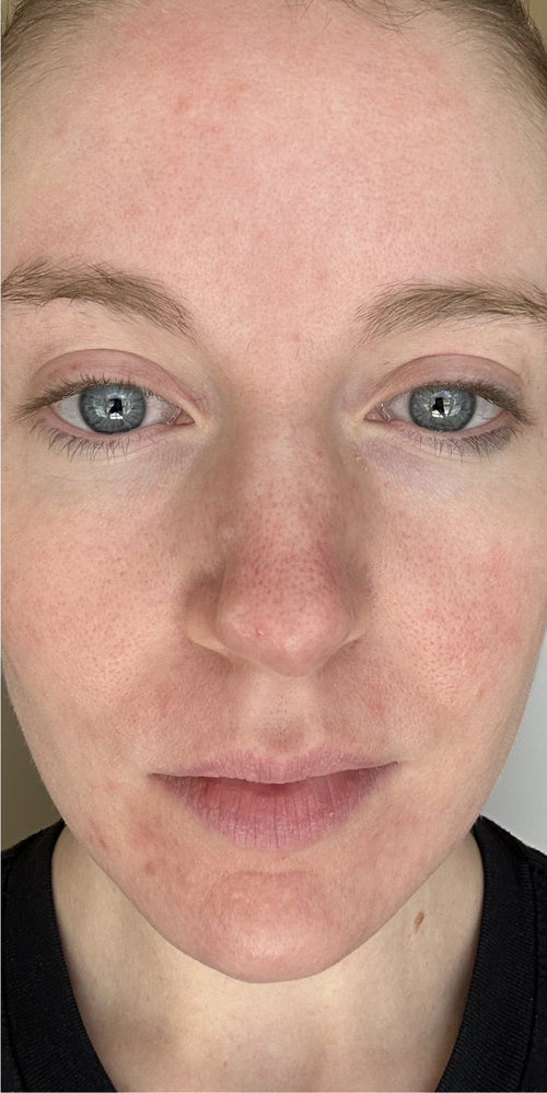 Close-up of a woman's makeup-free face.
