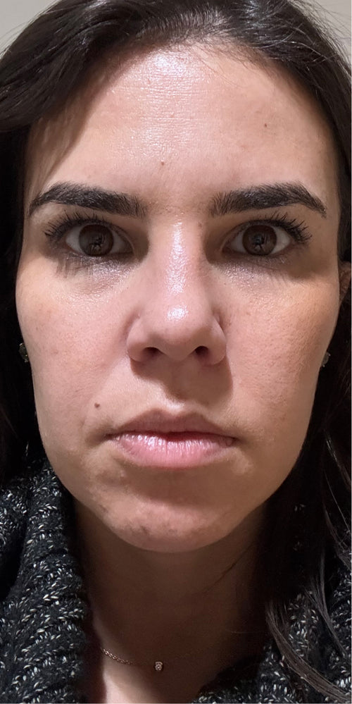 Close-up of a woman's makeup-free face.