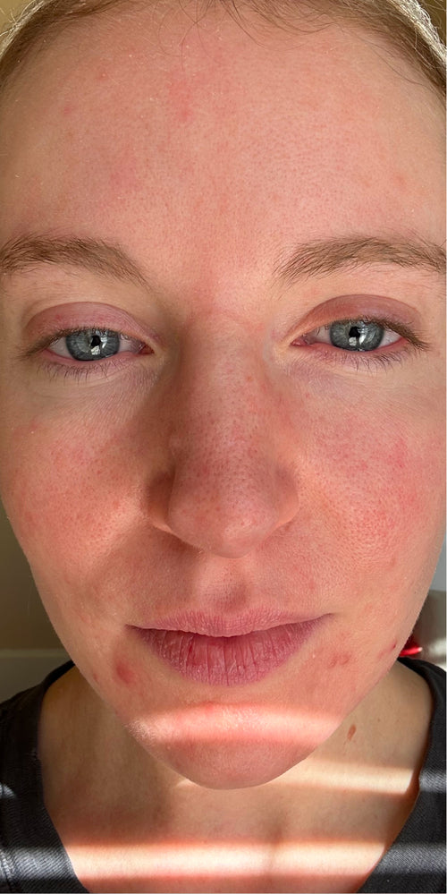 Close up of a woman's makeup-free face.