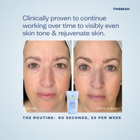 Flash 1 One-Minute Resurfacing Mask - TIMEBEAM Beauty