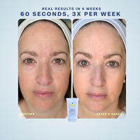 Flash 1 One-Minute Resurfacing Mask - TIMEBEAM Beauty