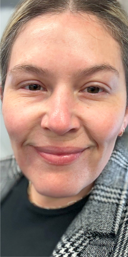 Close-up of a woman's makeup-free face.