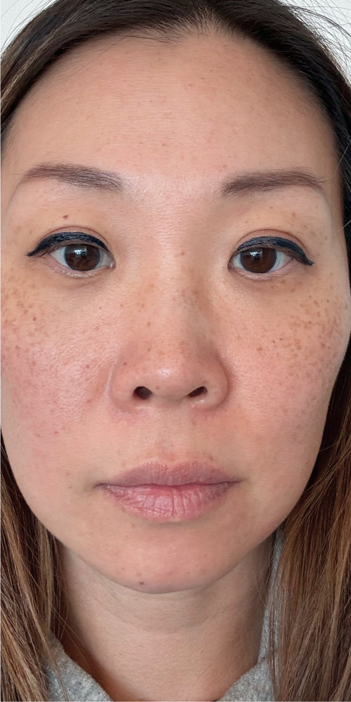 Close-up of a woman's makeup-free face.