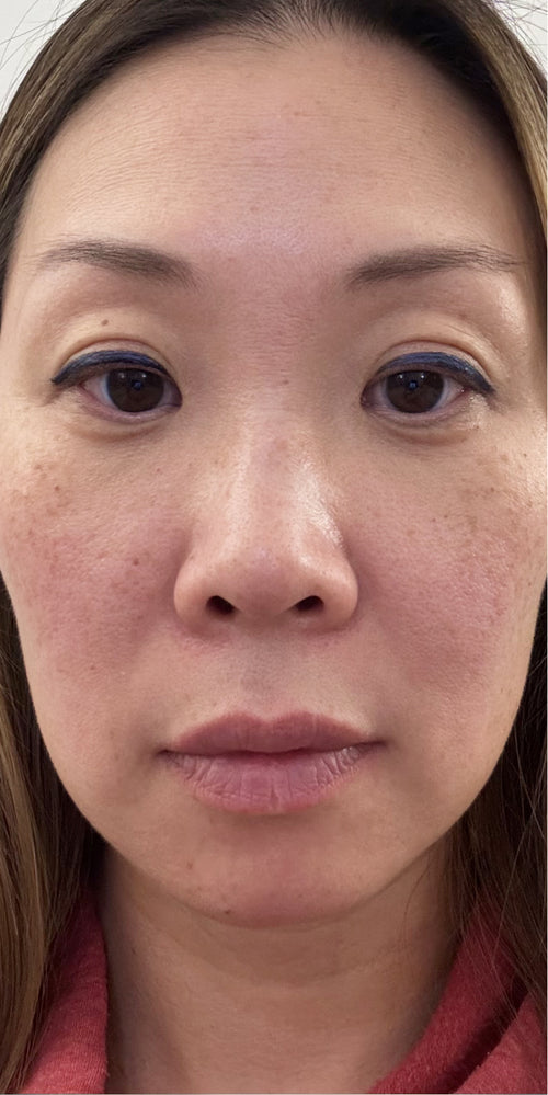 Close-up of a woman's makeup-free face.