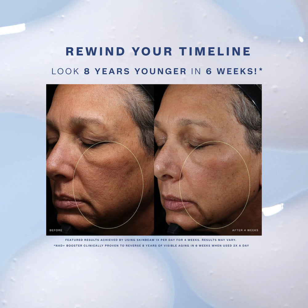 Skinbeam Milky Serum - TIMEBEAM Beauty