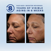 Skinbeam Milky Serum - TIMEBEAM Beauty