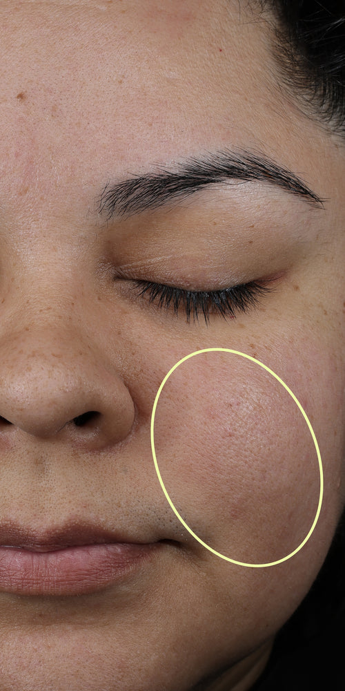 Close-up of a woman's makeup-free face with a circle on her cheek.